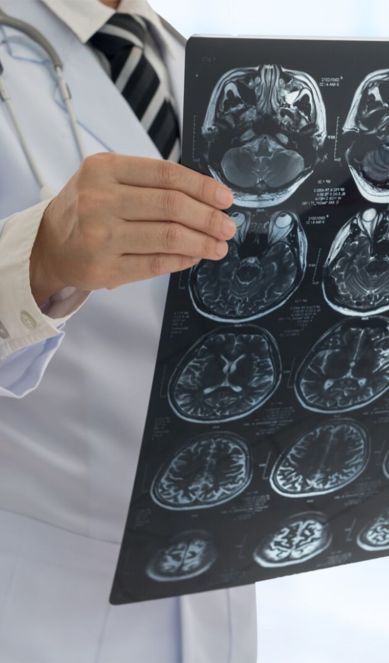 Doctor holding brain scan